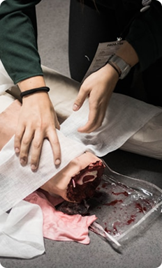 Severe Lacerations